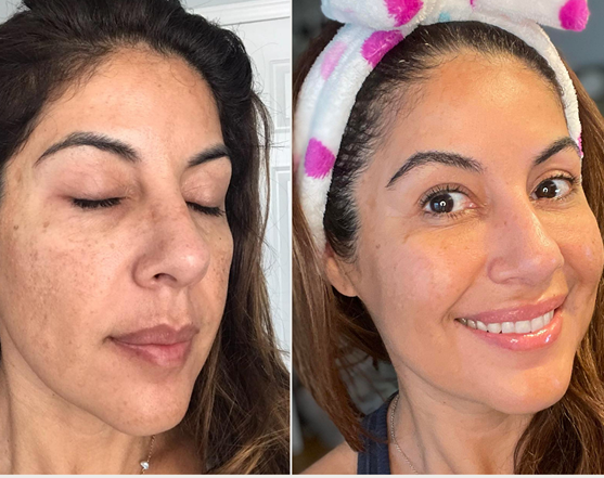 Relaxing Facial Tension